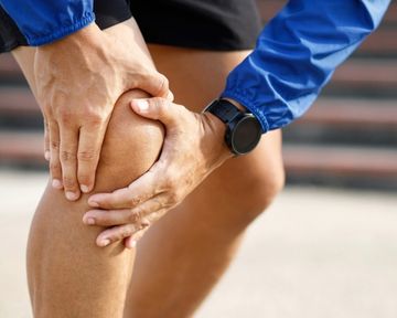 Varicose Veins